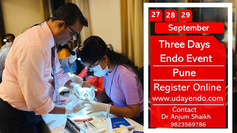 THREE DAYS ENDODONTICS Hands-on 